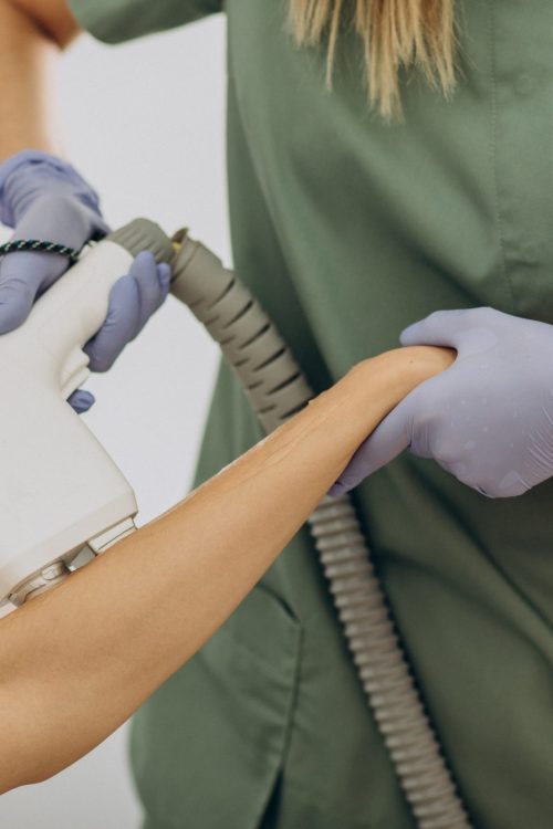 Laser epilation, hair removal therapy